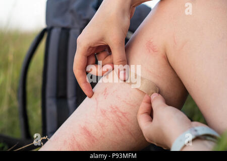 Anwendung der Pflaster Pflaster auf verletztes Bein im Freien. Schließen Sie herauf Bild der mit Klebeband verband brusied zu heilen und zerkratzt Bein auf wandern Wal Stockfoto