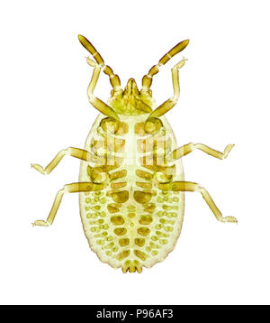 Wahre bug (Heteropteran). Unreife (ohne Flügel) Hellfeld photomicrograph Stockfoto