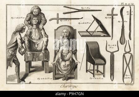 Op liegen mit Patienten für eine Blase Stein Betrieb durch die Leiste gehalten, Platte 12. Chirurgische Instrumente einschließlich dilatatoren 1-3, kürette 6 und Haken curette 7, Plate 11. Kupferstich von Robert Benard von Denis Diderots Enzyklopädie, Pellets, Genf, 1779. Stockfoto