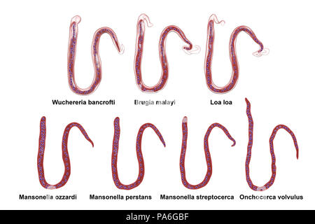 Vergleich der microfilariae Morphologie. Computer Abbildung: Umhüllten und ummantelte microfilaria Würmer unterschiedliche auch durch Schwanz Kerne Lage. Stockfoto