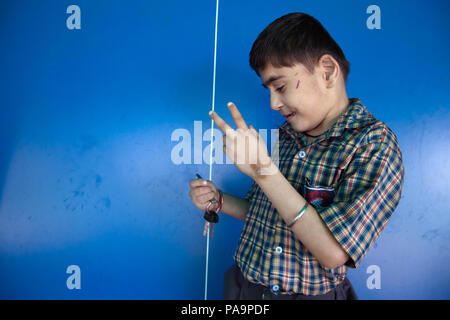 Behinderten Kindes an chingari Rehabilitationszentrum, Bhopal, Indien Stockfoto