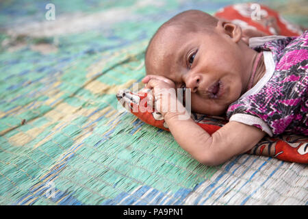 Behinderten Kindes an chingari Rehabilitationszentrum, Bhopal, Indien Stockfoto