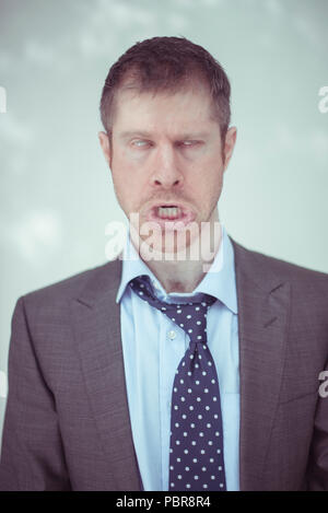Weißer Mann im grauen Anzug, eine ausgebrannte Gesicht Stockfoto