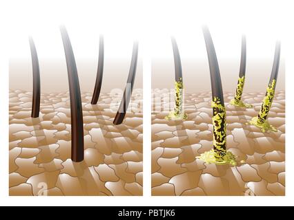 Ein Vektor Illustration der Haut und der Haare, normale und fettige oder mit übermäßiger Talgproduktion. Stock Vektor