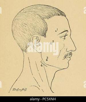14 Bertillon - Identifikation anthropométrique (1893) 357 Stockfoto
