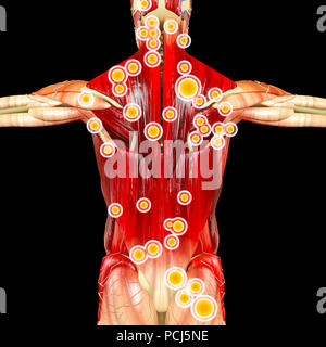 Zurück Blick auf einen Mann und seine Triggerpunkte. Anatomie Muskeln. 3D-Rendering. Myofasziale Triggerpunkte, werden als hyperirritable Spots beschrieben. Stockfoto