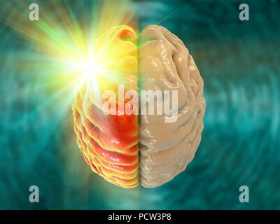 Migräne, konzeptionelle Computer Abbildung. Stockfoto