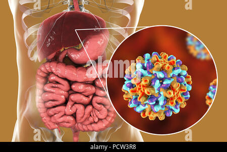 Hepatitis-B-Infektion. Computer Abbildung Leber angezeigt und Nahaufnahme der Hepatitis-B-Viren. Stockfoto