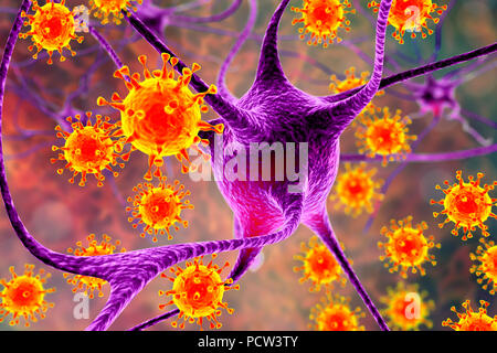 Virale Enzephalitis. Konzeptionelle Abbildung: Viren Nervenzellen zu infizieren. Stockfoto