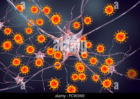 Virale Enzephalitis. Konzeptionelle Abbildung: Viren Nervenzellen zu infizieren. Stockfoto
