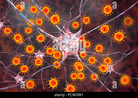 Virale Enzephalitis. Konzeptionelle Abbildung: Viren Nervenzellen zu infizieren. Stockfoto