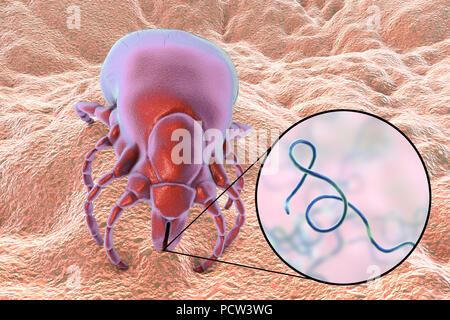 Borreliose Zecke, Illustration. Zecken (Gattung Ixodoidea) sind Parasiten, die sich auf Mensch und Tier Blut ernähren. Ihr Biss kann eine Reihe von Krankheiten wie Borreliose, die durch das Bakterium Borrelia burgdorferi verursacht wird übertragen. Stockfoto