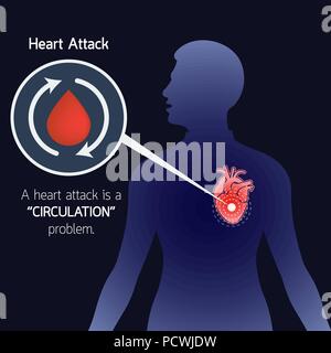 Herzinfarkt Vektor logo Symbol Abbildung Stock Vektor