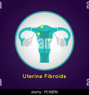 Uterine Fibroids logo Vektor Icon Design Illustration Stock Vektor