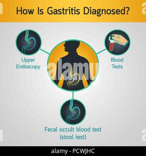 Gastritis Vektor logo Symbol Abbildung Stock Vektor