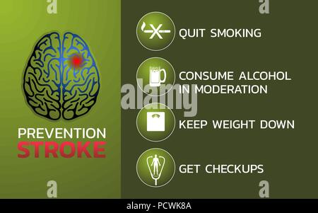 Prävention für Schlaganfall Icon Design, infografik Gesundheit, medizinische Infografik. Vector Illustration Stock Vektor