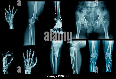 Sammlung x-ray in Blau Ton Stockfoto