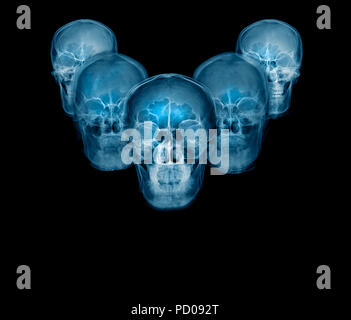 Röntgen Schädel Stockfoto