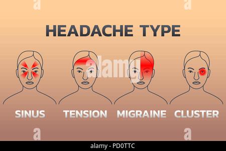 Arten von Kopfschmerzen Infografiken Design Template, Symbol Vektor illustration Stock Vektor