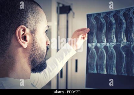 Nahaufnahme der männlichen Physiotherapeuten oder Chiropraktor oder Arzt Suchen an X-Ray Film der Wirbelsäule vor Leuchtkasten in Klinik Stockfoto