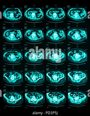 Reihenfolge der horizontale Abschnitte eines weiblichen menschlichen Gehirn, MRI-Scans, Magnetresonanztomographie, Stockfoto