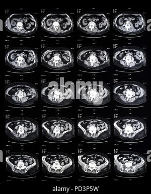 Reihenfolge der horizontale Abschnitte eines weiblichen menschlichen Gehirn, MRI-Scans, Magnetresonanztomographie, Stockfoto