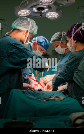 Arzt, Assistant und Krankenschwester bei einem Patienten während einer Hysterektomie Operation in einem Krankenhaus konzentriert Stockfoto