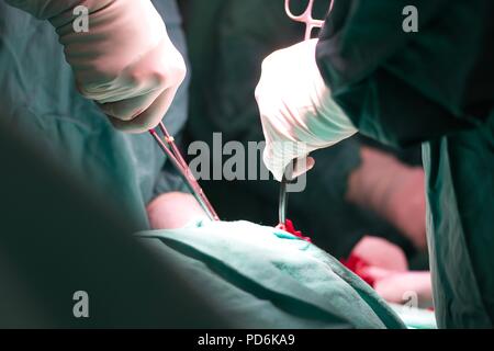 Ärzte Hand während der Operation im Operationssaal Nähe zu sehen. Stockfoto