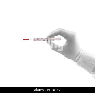 Arzt Hand in weißen Handschuh halten alte Thermometer. Medizinische Mann hält termometr im Arm. Chirurg hand mit rotem Quecksilber Thermometer. Therapeuten Anzeige thermometr Bildschirm. Für die medizinische Diagnostik Stockfoto