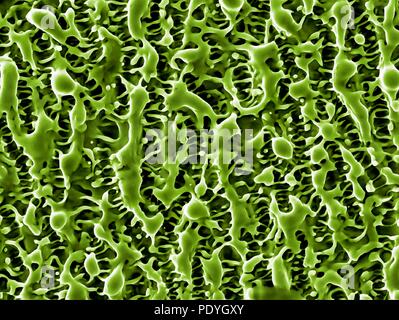 Nanostrukturen auf Nickel. Farbige Scanning Electron Micrograph (SEM) von Nanostrukturen auf einem Nickel Oberfläche durch einen Laserstrahl gebildet. Diese Forschung beinhaltet die Verwendung von Lasern auf Etch und Ablation der Metall- und Halbleiterindustrie Oberflächen. Die daraus resultierende Nanostrukturen können Anwendungen in verschiedenen Formen der Elektronik und der Nanotechnologie. Stockfoto