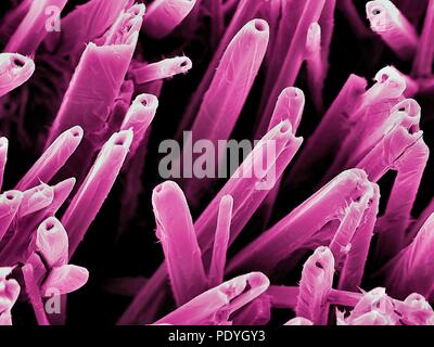 Nanostrukturen auf Vanadium. Farbige Scanning Electron Micrograph (SEM) von Nanostrukturen auf eine Vanadium und Vanadium oxid Oberfläche, die durch eine CO2-Laserstrahl gebildet. Diese Forschung beinhaltet die Verwendung von Lasern auf Etch und Ablation der Metall- und Halbleiterindustrie Oberflächen. Die daraus resultierende Nanostrukturen können Anwendungen in verschiedenen Formen der Elektronik und der Nanotechnologie. Stockfoto