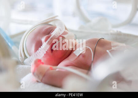 Frühgeburt im Inkubator Stockfoto