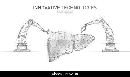 Robotic Leberchirurgie Low Poly. Polygonale hepatitis Chirurgie Verfahren. Roboterarm Manipulator. Moderne innovative Medizin Wissenschaft Automatisierungstechnik. Dreieck 3D-Render Form Vector Illustration Stock Vektor