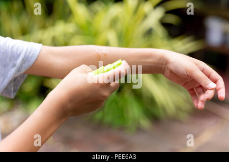 Junge spritzen Insektenschutzmittel gegen Moskitos Bisse auf seinem Arm in den Garten Stockfoto