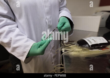 Labortechniker Blutanalyse Tasche Stockfoto