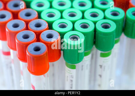 Gruppe von medizinisch, grüne und rote Probenröhrchen, Röhrchen Blut für im Labor Krankheit des Patienten zu diagnostizieren Stockfoto