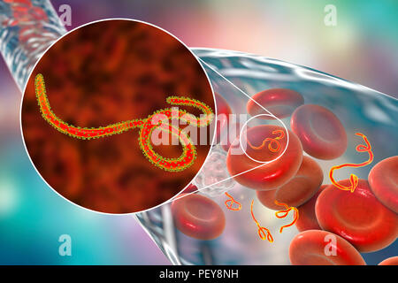 Ebola virus Partikel im Blut, computer Abbildung. Dieses Virus ist die Ursache der Krankheit Ebola Virus bei Menschen und Primaten. Es ist eine schwere und oft tödliche Krankheit mit Symptomen wie Fieber, Müdigkeit, Muskelschmerzen, Erbrechen, Durchfall und Blutungen (innere Blutungen). Es gibt keine Heilung für die Krankheit, aber drei Viertel der Patienten wiederhergestellt werden kann, wenn ausreichende medizinische Unterstützung. Stockfoto