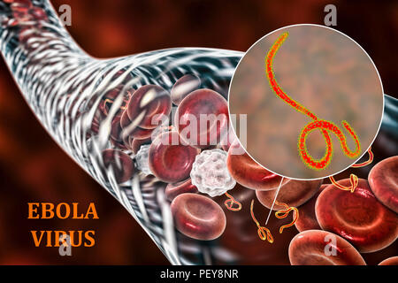 Ebola virus Partikel im Blut, computer Abbildung. Dieses Virus ist die Ursache der Krankheit Ebola Virus bei Menschen und Primaten. Es ist eine schwere und oft tödliche Krankheit mit Symptomen wie Fieber, Müdigkeit, Muskelschmerzen, Erbrechen, Durchfall und Blutungen (innere Blutungen). Es gibt keine Heilung für die Krankheit, aber drei Viertel der Patienten wiederhergestellt werden kann, wenn ausreichende medizinische Unterstützung. Stockfoto
