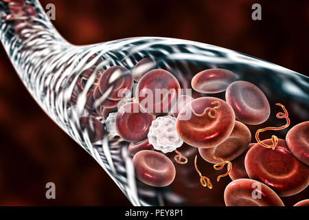 Ebola virus Partikel im Blut, computer Abbildung. Dieses Virus ist die Ursache der Krankheit Ebola Virus bei Menschen und Primaten. Es ist eine schwere und oft tödliche Krankheit mit Symptomen wie Fieber, Müdigkeit, Muskelschmerzen, Erbrechen, Durchfall und Blutungen (innere Blutungen). Es gibt keine Heilung für die Krankheit, aber drei Viertel der Patienten wiederhergestellt werden kann, wenn ausreichende medizinische Unterstützung. Stockfoto