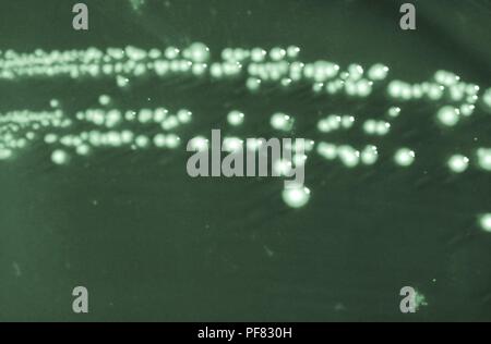 Shigella boydii Kolonien von Bakterien auf einem Hektoen enterischen (ER) Agaroberfläche, 1976 angebaut. Mit freundlicher Seuchenkontrollzentren (CDC). () Stockfoto