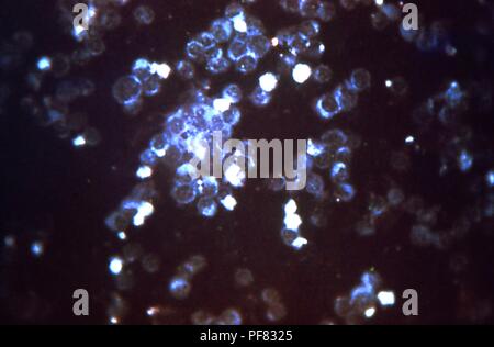 Respiratory Syncytial Virus (RSV), Negativ-sense umhüllte RNA-Virus, offenbart die photomicrograph Film mittels indirekter Immunfluoreszenz Technik, 1977. Mit freundlicher Seuchenkontrollzentren (CDC)/Dr H. Craig Lyerla. () Stockfoto