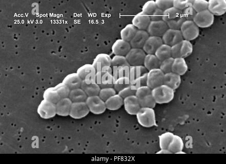 Gram-negative, nicht-Motilen ACINETOBACTER BAUMANNII Bakterien im 13331 x vergrößert Rasterelektronenmikroskopische (SEM) Bild 2004 aufgedeckt. Mit freundlicher Seuchenkontrollzentren (CDC)/Matthew J. Arduino, DrPH, Janice Carr, Jana Swenson. () Stockfoto