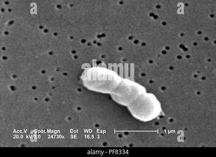 Gram-negative, nicht-Motilen ACINETOBACTER BAUMANNII Bakterien im 24730 x vergrößert Rasterelektronenmikroskopische (SEM) Bild 2004 aufgedeckt. Mit freundlicher Seuchenkontrollzentren (CDC)/Matthew J. Arduino, DrPH, Janice Carr, Jana Swenson. () Stockfoto