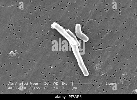 Gram-positive Bakterien Mycobacterium Tuberkulose in der 13172 x vergrößert Rasterelektronenmikroskopische (SEM) Bild 2006 aufgedeckt. Mit freundlicher Seuchenkontrollzentren (CDC)/Ray Butler, MS, Janice Haney Carr. () Stockfoto