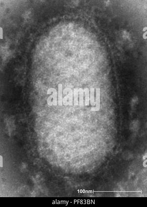 Ultrastrukturforschung Details eines Orf-Virus im negativen aufgedeckt - gebeizt Getriebe Elektronenmikroskopischen (TEM) Bild, 2004. Mit freundlicher Seuchenkontrollzentren (CDC)/Dr A. Likos. () Stockfoto