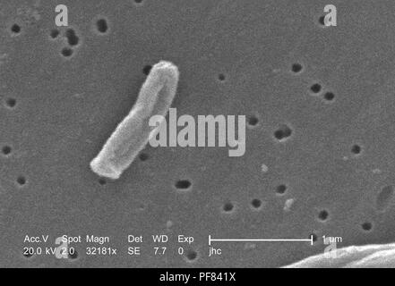 Ultrastrukturforschung Details von Gram-positiven Bakterien Mycobacterium Tuberkulose in der 32181 x offenbart vergrößerte Rasterelektronenmikroskopische (SEM) Bild, 2006. Mit freundlicher Seuchenkontrollzentren (CDC)/Ray Butler, MS, Janice Haney Carr. () Stockfoto