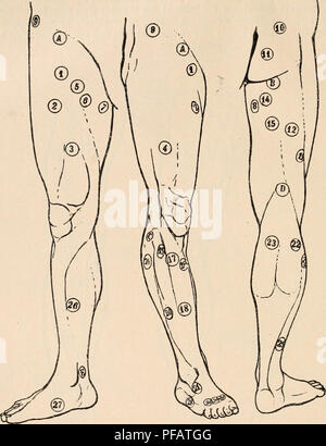 . Wörterbuch de Physiologie. Physiologie. 408 ELECTRICITÉ (THÉRAPEUTIQUE).. Abb. 203. - Alembre inférieur. Gesicht interne (Abb. 1): Gesicht des EXTERNE-Projekts (Abb. 2); Gesicht postérieure (Abb. 3). Abb. 1. Abb. 2. Fio. ein PLEXUS LOMBAIRE. Abb. 1. Abb. 2. Fio. 3 13 A 1 2 A 1 2 - Territoire du nerf Cruraldrüsen. Nerf Cruraldrüsen. M. Couturier. M. Droit antérieur (1}. - C 10 17 14 15 3 4 - M. Vaste interne (2). M. Vaste externe. - 18 - 5 - - M. von Pectine (3).    V.&gt; Territoire du Nerf obturateur. - 20 - 6 M.Premier adducteur. - 21 - 7 - M. Droit interne. --D" 8 M. Troisième ou Grand adducteur. PLBXyS SACRÉ. T Stockfoto