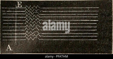 . Wörterbuch de Physiologie. Physiologie. 380 ÃLECTRICITÃ (Poissons Ã©lectriques). Suite de l'excitalion du Lappen Ã©lectrique. La Abschnitt des nerfs qui commandent l'gefunden worden, der besagte, Ã©lectrique paraÃ® t influer considÃ © rablement sur l'excitabilitÃ © De ce Letzte, II rÃ©sulte des Forschung rÃ©centes de Garten (37), qui a pu Garder en vie des torpilles avec Les nerfs sectionnÃ©s d'un Côté tÃ© jusqu'à trente-sept jours, que lorsque l'exci-tabilitÃ © du nerf disparaÃ® t (au 19" = jour), l'gefunden worden, der besagte devient aussi directement inexcitable. Lajiertede l'excitabilitÃ © survient Après-ski une pÃ©riode mehr oder weniger Lo Stockfoto