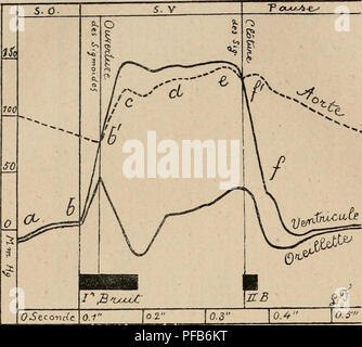 . Wörterbuch de Physiologie. Physiologie. 458 CARDIOGRAPHE.. Abb. 14. Â TracÃ© s de pression recueillis simultanÃ©menc dans l'oreillette gauche dans le ventricule gauche et dans l'aorte chez le Chien. ab, die systole de l'oreillette. Â bcdef, die systole du ventricule. "Bb" et f, Ouverture et "Clínica' tur des sigmoÃ ¯ des artÃ © Rielles. (LÃ© auf Fredericq. ÃlÃ ©- de Physiologie, 3 "Ã©dition, Abb. 37.) L'auteur admet-Ã©galement que la "Clínica' tur des sigmoÃ ¯ des Se fait non en f, Mais en f; Il se Base sur les rÃ©sultats fournis par l'inscription simultanÃ©e de la Pression dans l'aorte. L'ondulation/c Stockfoto