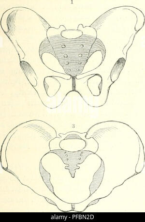 . Der Mensch. Anthropologie; die menschliche Anatomie, Physiologie. SaS-S3 ecfen. 407^ie^ üftgefcnfpfanue luirb von Einems fdjarfen 9 knbe begrenst, ber eine bem imd; nhuärtio feljeubcn 3 ianbe uoii 1963 2 (ii! ofcfjnitte (Incisura acetabulij unterbrod) en luivb. S^ie fonft glatte innere % angeschmutzt) t jcigt Fid) eine itjrer bin meiften anicgetieften Stelle in ber ältittc ranlj Jur3lnl; eftung Tot^ inneru ftarfen, runben@elenf 6 anbe § (Ligamentum rotundum). © a^3 niei 6 tid) e33 Eden ift im allgemeinen weiter nnb Üirjer aly Ba^niännlidje, unb feine Sarmbeinfdjanfehi finb etiuasS Kop) Cv geftellt, metjr aufgebogen (w. 3 lbbilbu Stockfoto